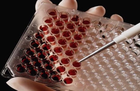 Ετεροφυλοφιλική μετάδοση του HIV: νέες ανακαλύψεις