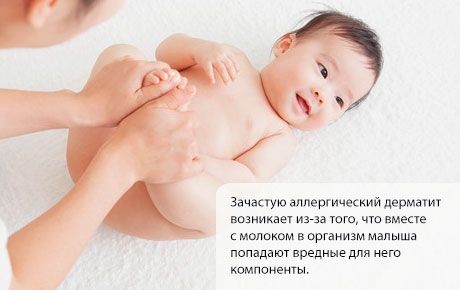 Αλλεργική δερματίτιδα σε ένα παιδί